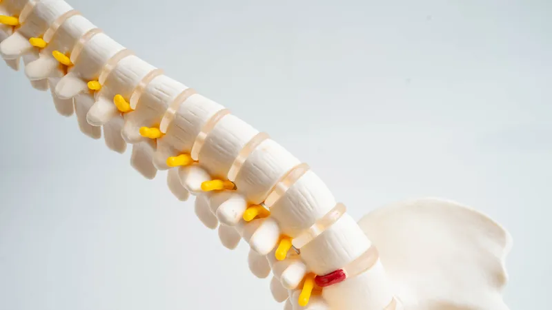 Lumbar spine anatomy model